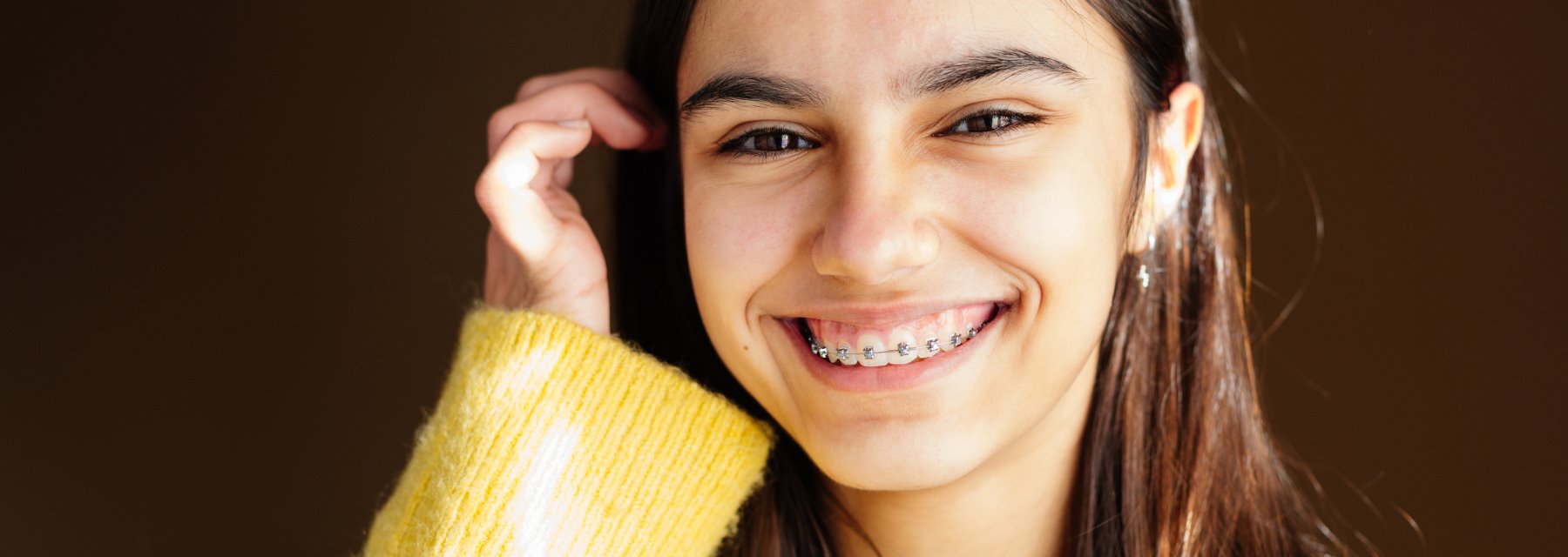 Types of Braces at Alabama