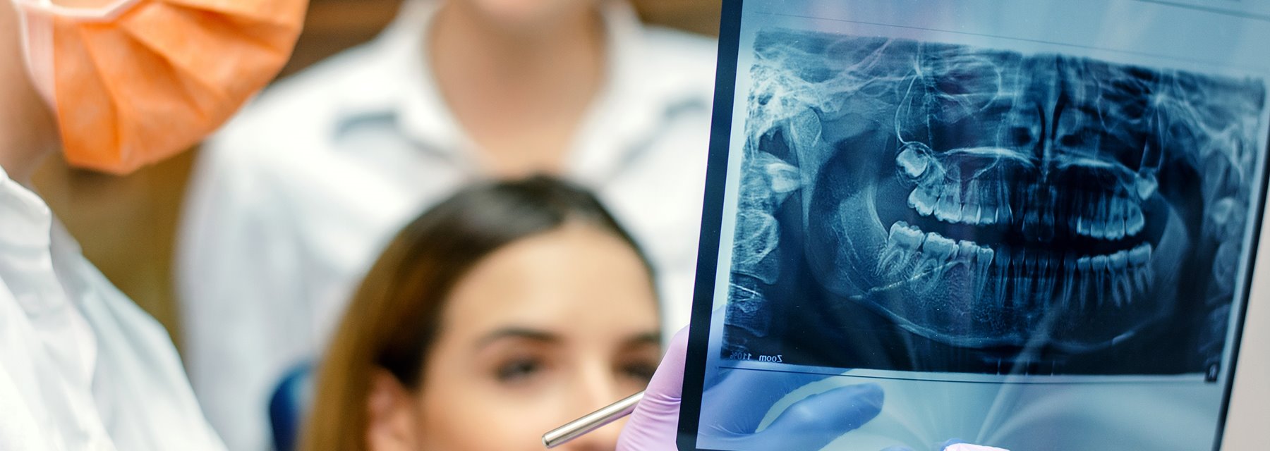 Orthognathic Surgery at McCalla
