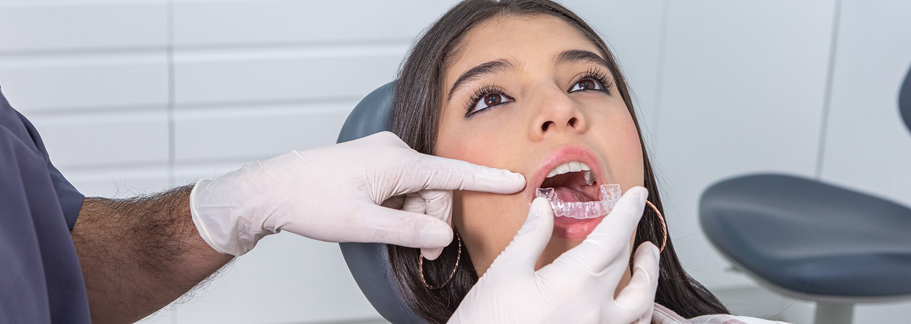 Retention result after remove your braces at Alabama